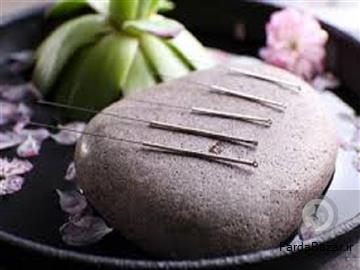 اموزش تخصصی طب سوزنی