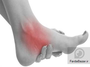 اسکن کف پا در غرب تهران